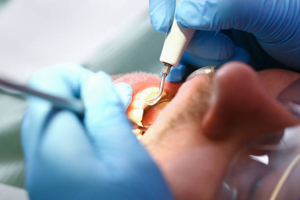 Best Emergency Cosmetic Dentistry (e.g., broken veneers) in Van Meter, IA
