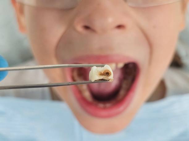 Best Emergency Care for Gum Disease in Van Meter, IA